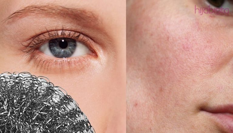 Elak Efek Yang Mengerikan Pada Wajah, Ini 5 Tanda Kulit ‘Over’ Eksfoliasi