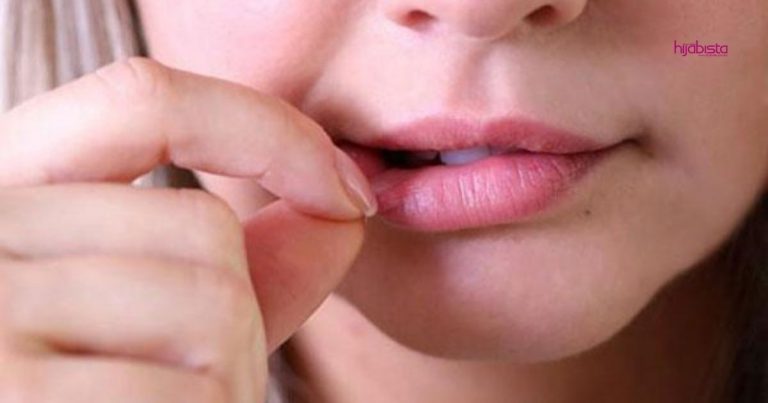 Tak Pakai Lipstik Pun Tak Apa, Bibir Hitam Lebam Boleh Jadi Merah Semula Jadi, Ini Caranya