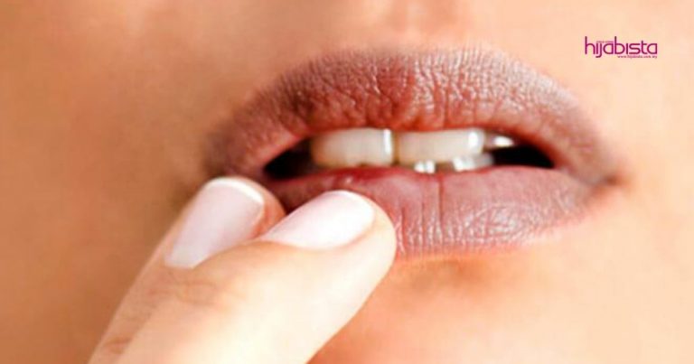Doktor Ini Jelaskan Sebab Bibir Jadi Gelap Salah Satunya Tabiat Gigit Bibir