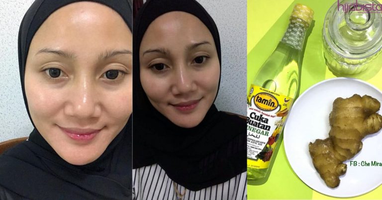 Hasil Macam Pergi Spa, Wanita Kongsi Tip Wajah Jadi Flawless Guna 2 Bahan Sahaja