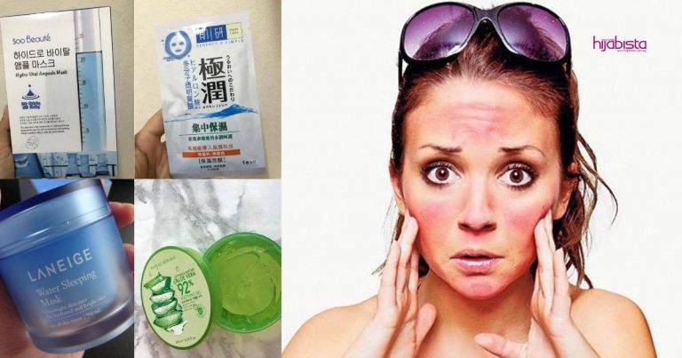 Kulit Sunburn Jadi Merah & Pedih, Gadis Ini Kongsi Cara Rawat Kulit Sunburn Salah Satunya Pakai Sleeping Mask