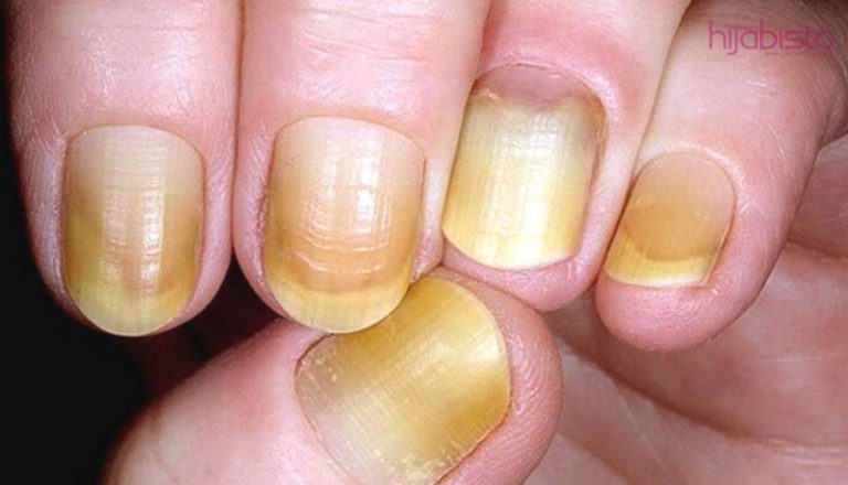 Jangan Pandang Remeh, 7 Tanda Ini Boleh Jadi Badan Anda Tidak Sihat