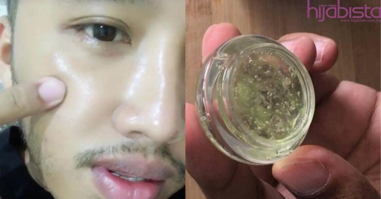 Rahsia Kulit Jadi Flawless Bak Putih Telur, Perkongsian Lelaki Ini Dapat Tumpuan 25k Netizen