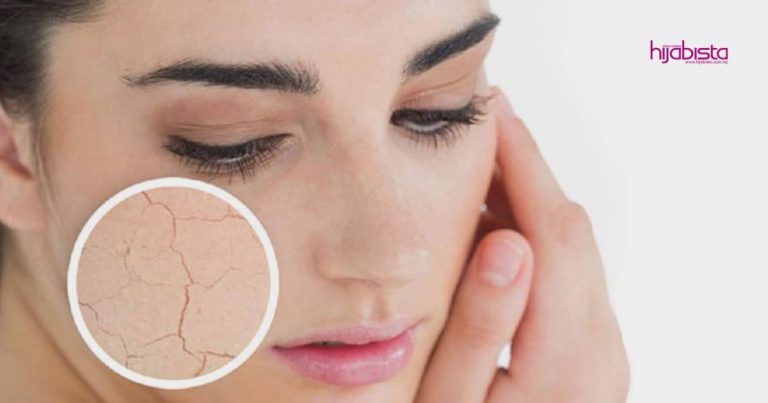 Kulit Kering Kalau Tak Dijaga Boleh Jadi Kusam & Hilang Seri, Ini Yang Boleh Diamalkan