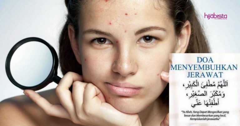 Ini Doa Untuk Sembuhkan Jerawat, Boleh Baca Bila Sapu & Bersihkan Bahagian Yang Kena