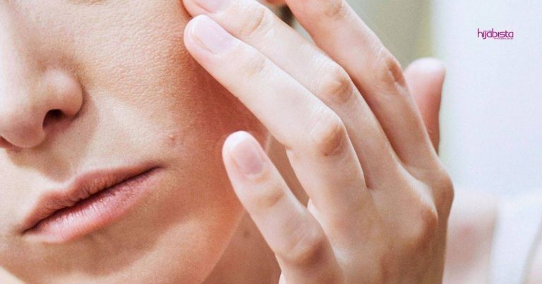 Ini Cara Rawat Kulit Sensitif Yang Kering, Kusam, Berbintik Merah & Tona Tidak Sekata Akibat Kesan Alergik