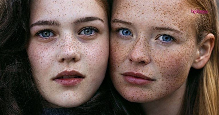 Jika Kulit Wajah Penuh Jeragat, Ini Yang Perlu Kita Tahu Salah Satunya Mesti Pakai Sunblock