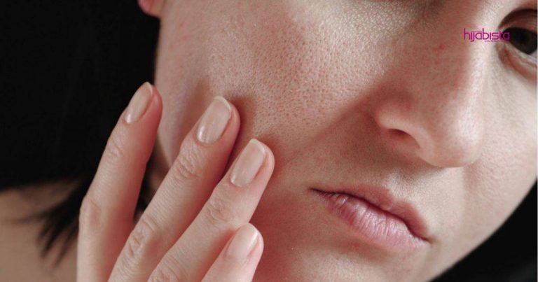 Doktor Ini Kongsi Cara Rawat Kulit Kering Mengelupas Salah Satunya Mesti Pakai Sunscreen & Pelembap