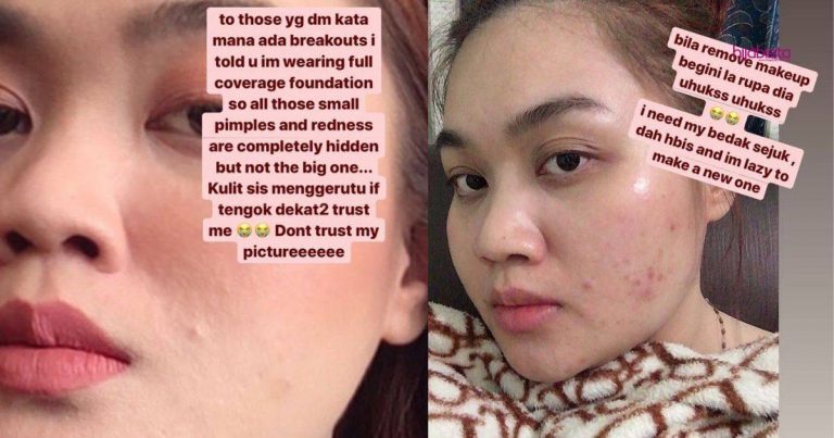 Wanita Ini Kongsi Produk Yang Dia Guna, Tak Semestinya Yang Mahal Sahaja Mujarab Rawat Kulit Wajah
