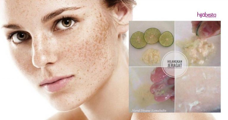 Hilangkan Jeragat Dengan Campuran Limau Nipis & Susu Tepung, Boleh Cuba Cara Wanita Ini Buat