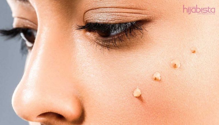 Cara Memilih Concealer Yang Tepat Dan Trik Mudah Membetulkan Solekan