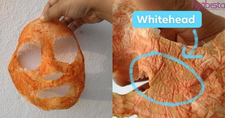 Hanya Guna 3 Bahan Je, Whitehead & Blackhead Degil Pasti Hilang Dengan Cara Ini!