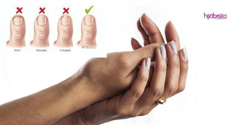 Potong Kuku Ada Caranya, Tidaklah Nanti Kena Cagu, Doktor Ini Kongsi Cara Cegah & Rawatan