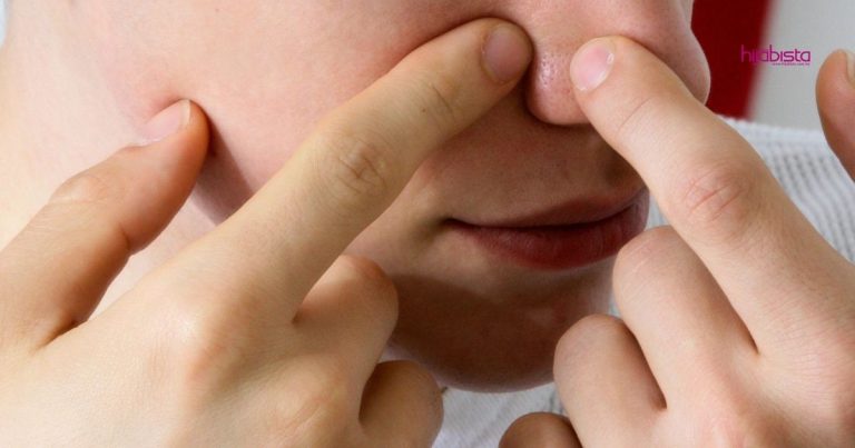 Jerawat Jadi Kecut Bila Sapu Campuran Manjakani & Tepung Kacang Hijau, Wanita Ini Kongsi Caranya