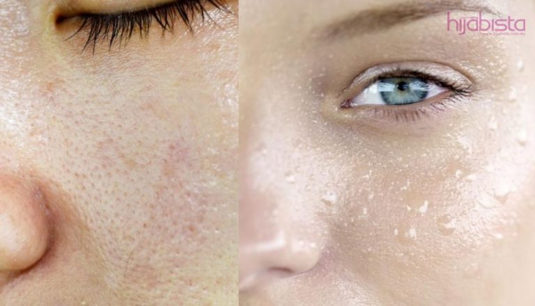 Penyebab Muka Berminyak Yang Anda Boleh Uruskan Sebelum Terlambat