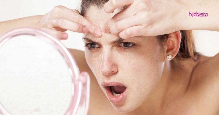 Rawat Breakout Dengan Cari Punca Breakout, Amalkan ‘Skincare Diet’, Guna Produk Yang Perlu Sahaja