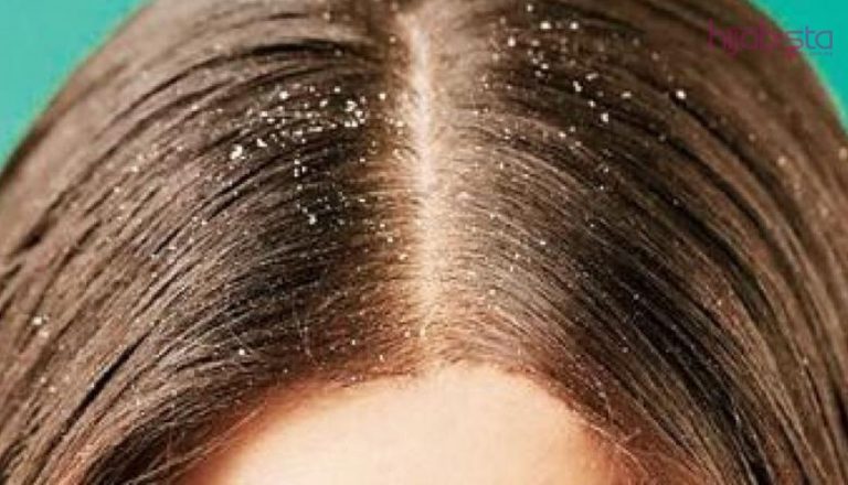 Bahaya Kelemumur Bukan Sahaja Di Kepala, Malah Beri Kesan Sampingan Pada Kulit Wajah Dan Badan