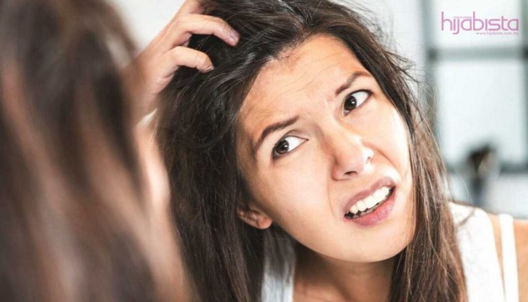 Kelemumur atau Kulit Kepala Kering? Gejala, Rawatan, dan Banyak Lagi Yang Perlu Anda Tahu