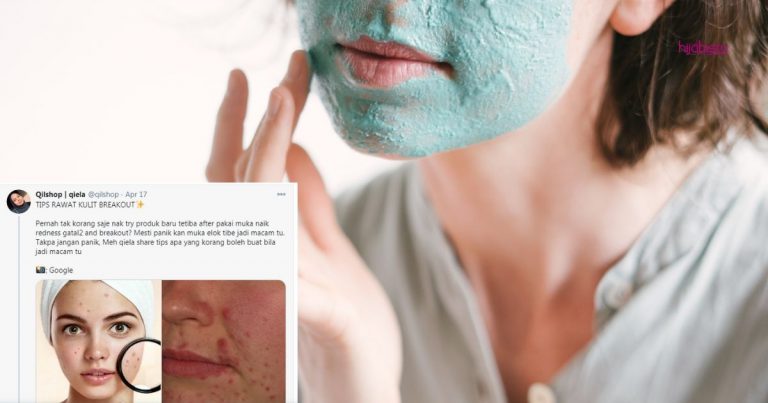 Bila Cuba Produk Baru Kulit Wajah Jadi Breakout, Gadis Ini Kongsi Tip Cara Atasi
