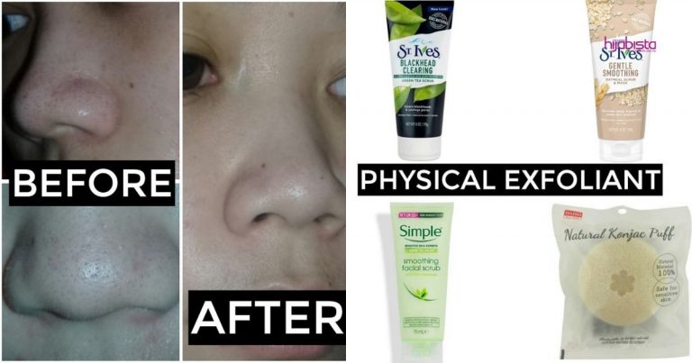 Rasa Kasar Macam Kertas Pasir Bila Pegang Hidung, Wanita Ini Kongsi Cara Rawat Bintik Hitam