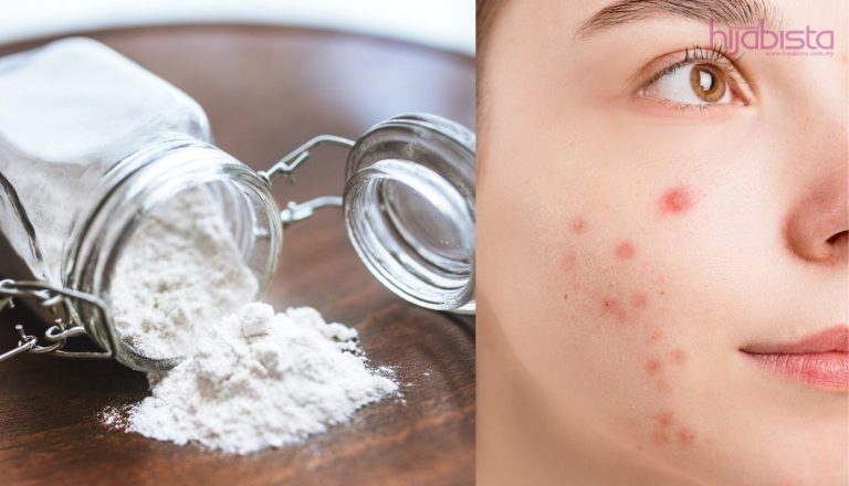 Kegunaan Baking Soda Dalam Rutin Penjagaan Kulit. Cukup Mengagumkan Hilangkan Jerawat