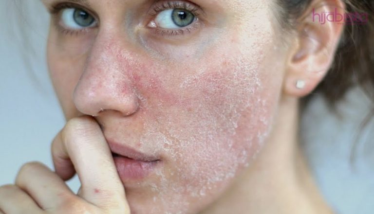 Cara Menguruskan Kulit Kering Dengan 4 Kaedah Ini. Hasilnya Kulit Kekal Lembap Dan Segar