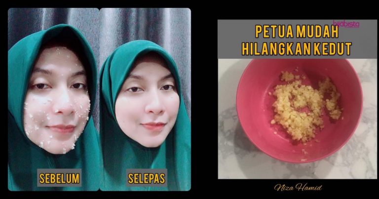 Hilangkan Kedut Dengan Bawang Putih, Garis Halus Hilang, Wajah Pun Nampak Awet Muda