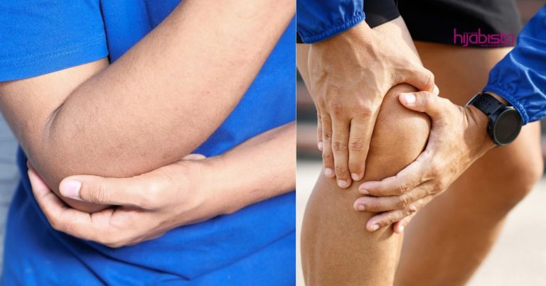 Cerahkan Kulit Siku & Lutut Yang Gelap, Mudah, Bajet & Senang Nak Buat
