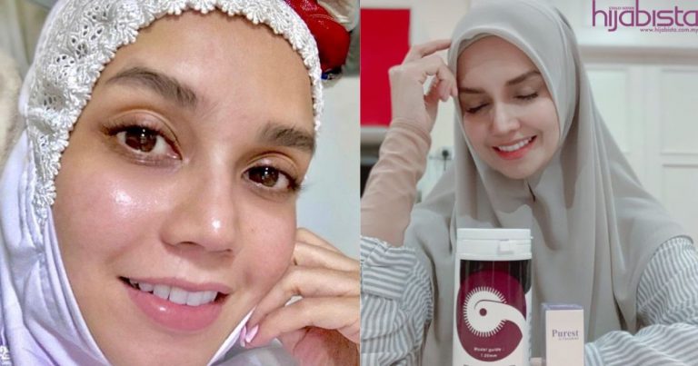 ‘Kenapa Malu Dengan Flaws? No One Is Perfect!’-Ini Nasihat Faezah Elai Buat Yang Rasa Rendah Diri