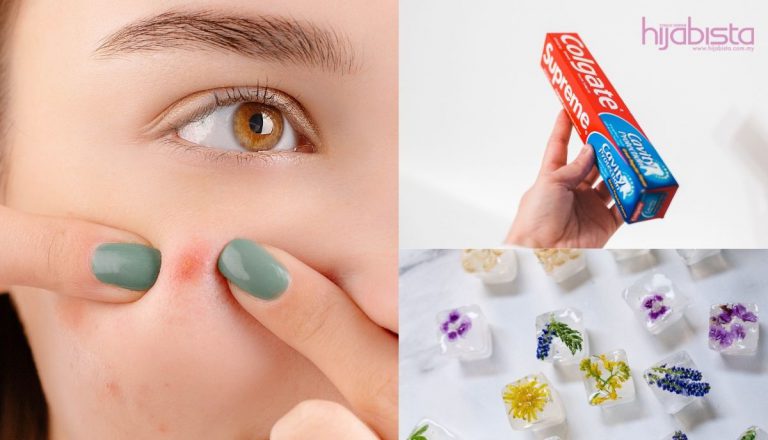 Cara Menghilangkan Jerawat Dengan Cepat dan Murah