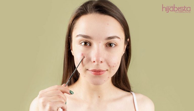 Cara Menghilangkan Jerawat Remaja, Hanya Lakukan Di Rumah