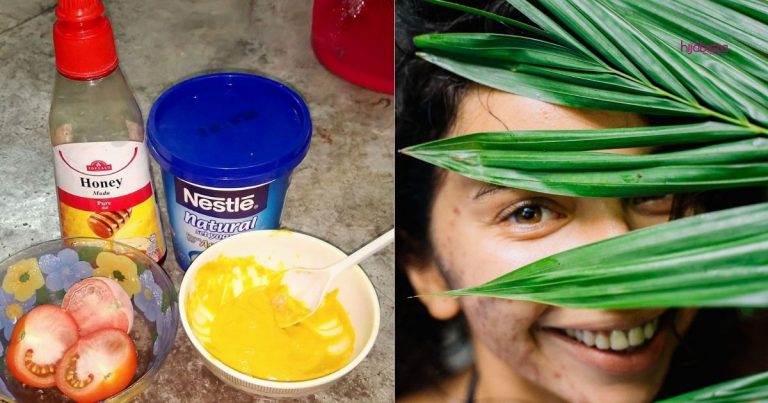 Pulihkan Jerawat Dengan Petua Mudah Guna Tomato + Madu + Serbuk Kunyit + Yogurt