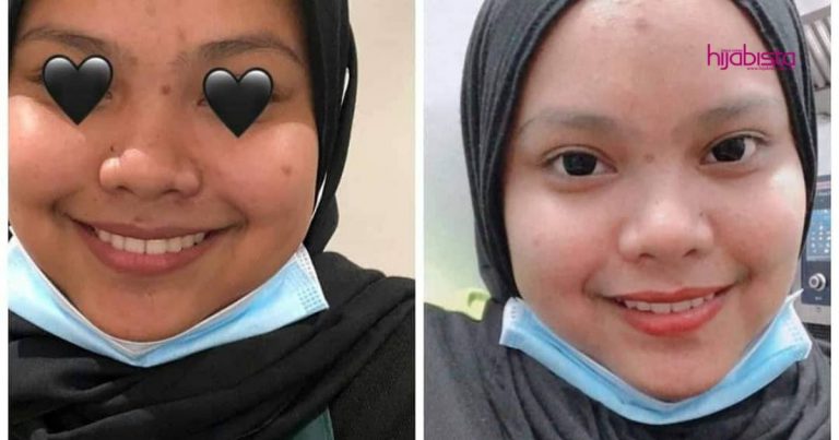 Gadis Ini Kongsi Tip ‘Handle’ Masalah Breakout Kuncinya Jangan Stres & Mesti Sabar