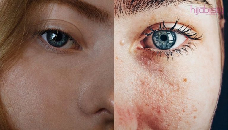 6 Tanda Anda Mempunyai Kulit Kombinasi dan Cara Atasinya Dengan Rutin Penjagaan Kulit Pagi & Malam