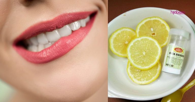 Putihkan Gigi Sepantas 5 Minit, Guna Soda Bikarbonat & Lemon, Memang Menjadi!