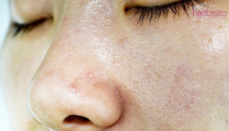 Produk Yang Tepat Dapat Menghilangkan Kulit Muka Berminyak. Patuhi Langkah-Langkah Untuk Memilih Produk Terbaik.