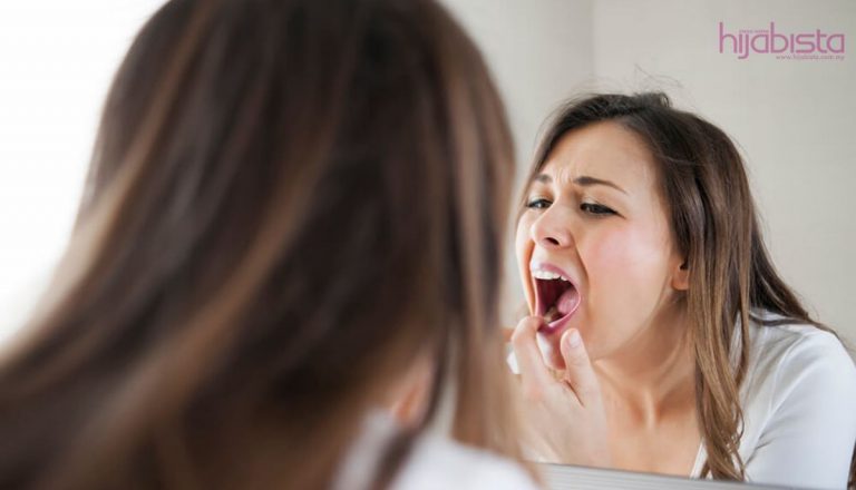 Masalah Gigi Bukan Masalah Biasa. Rawat Masalah Gigi Untuk Tampil Cantik Menawan.