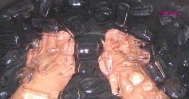 Amalkan Rendam Kaki Dalam Ais, Elok Untuk Sakit Kepala, Sukar Tidur, Sakit Badan & Ada Gangguan Makhluk Halus