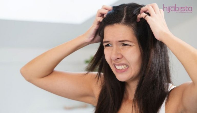 Kepala Selalu Gatal, Rupanya Kurap Di Kepala!