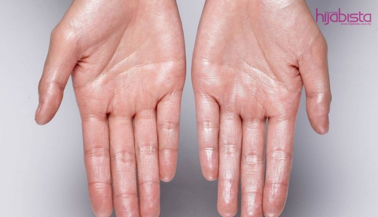 Tapak Tangan & Tapak Kaki Berpeluh Teruk, Hilangkan Keyakinan Diri & Ganggu Emosi. Ini Rawatannya!
