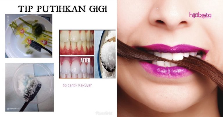 Putihkan Gigi Dengan Guna Lemon & Garam, Tiada Kesan Sampingan & Yang Penting Jimat!