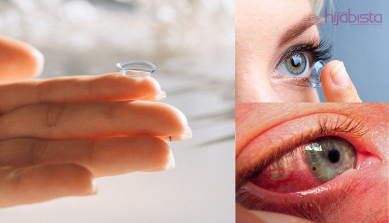 Hijabi Ini Serik Pakai Contact Lens, Kornea Mata Luka Akibat Beli Di Kedai Biasa