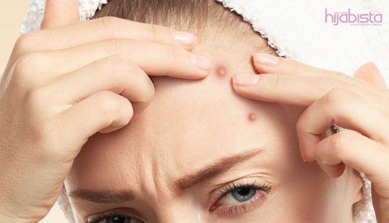 Punca Jerawat Pasir Tumbuh Di Dahi, Awas Wanita Berhijab Sering Alaminya