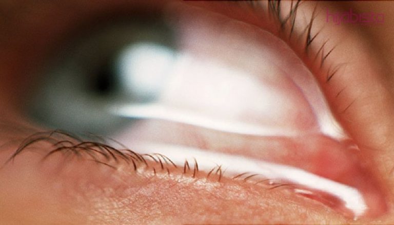 Mata Selalu Berair, Fahami Kesihatan Mata Anda!