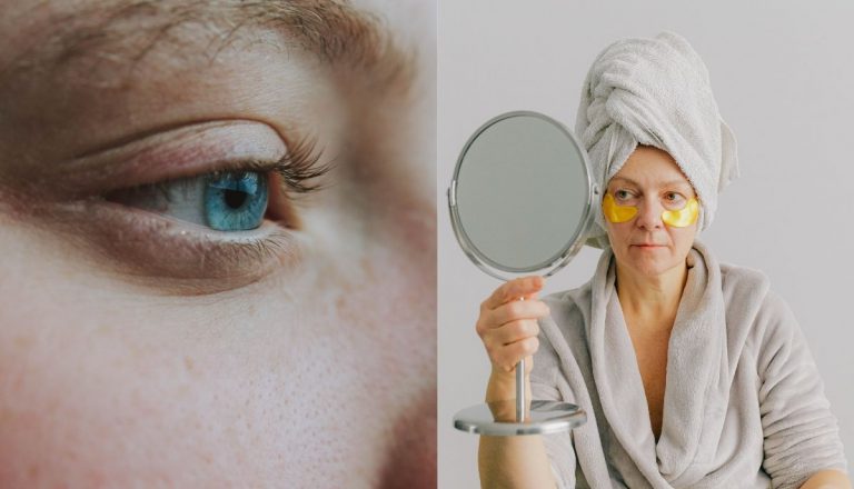 Cara Mudah Hilangkan Kedut Bawah Mata Tanpa Risau & Kekal Awet Muda.