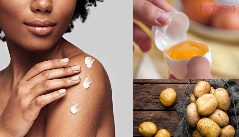 Susahnya Nak Hilangkan ‘Stretch Mark’! Cara Tadisional Ini Solusinya, Buat Di Rumah Sahaja