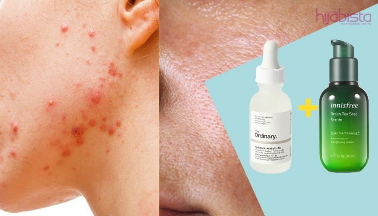 Kombo Penjagaan Kulit Terbaik, Serum Dan Pelembap Atasi Masalah Kulit Wajah Anda