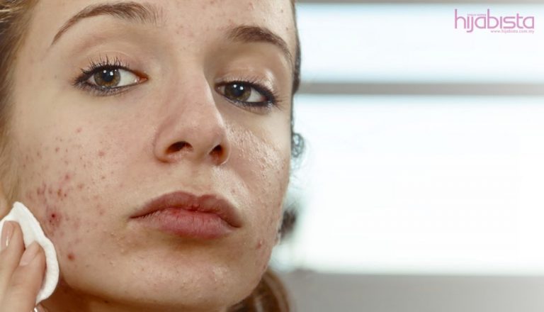 Adakah Aku Penghidap Ovari Polisistik (PCOS)? Kenali Lebih Mendalam Mengenai Penyakit Merbahaya Ini!