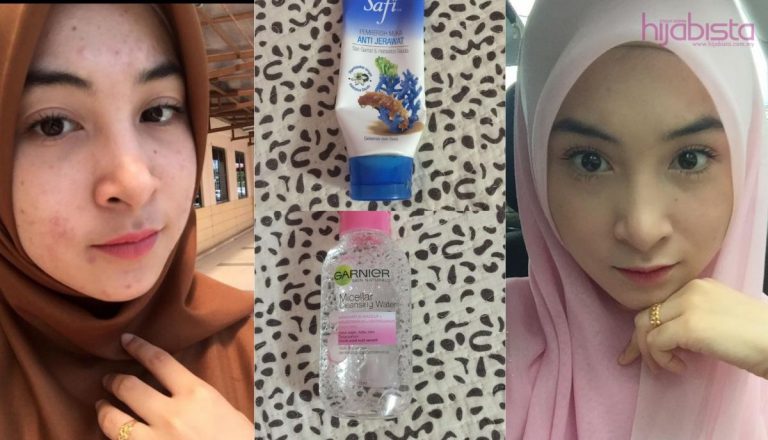 Hijabi  Ini Atasi Wajah Rosak Teruk Akibat Alergi, Hanya Dengan 7 Produk ‘Drugstore’