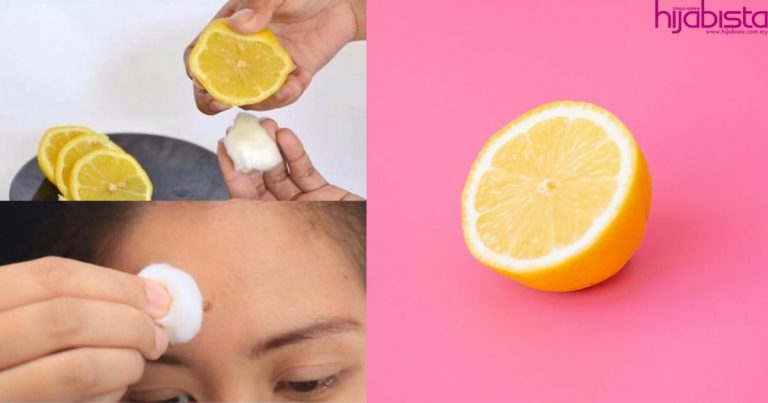 Hanya Pakai Jus Lemon, Parut Jerawat Degil Hilang Terus Dari Wajah!